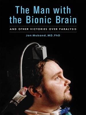 The Man with the Bionic Brain - ebook